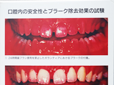 日本構造医学会学術会議にて掲示された電離性酸化水のポスター